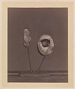 Excised Knee Joint. A Round Musket Ball in the Inner Condyle of the Right Femur [Gardiner Lewis, Company B, Nineteenth Indiana Volunteers]