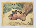 The Gout, James Gillray British, Hand-colored soft-ground etching