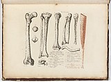 Anatomie du gladiateur combattant applicable aux beaux arts, ou Traité des os, des muscles, du mécanisme de mouvemens, de proportions et des caractères du corps humain (Anatomy of the Fighting Gladiator), Paris (Salvage), 1812, Written and illustrated and published by Jean-Galbert Salvage (French, 1770–1813), Folio volume (74 pp.) illustrated with 22 engravings printed in black and red ink; bound in red boards; red leather spine with gold-stamped ornament
