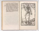 De dissectione partium corporis humani libri tres, Charles Estienne (French, Paris ca. 1504–1564 Paris), Woodcut