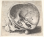 Sectioned skull in profile to left with the left side of the cranium removed, Wenceslaus Hollar  Bohemian, Etching; only state