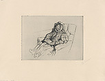 Convalescent, or Mumps, Carl Larsson Swedish, Etching