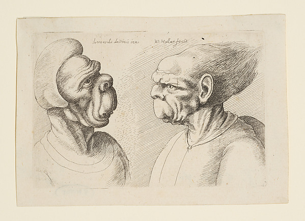 Two Deformed Heads with Very Long Upper Lips