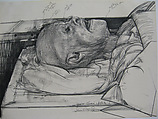 Gross Clinic - Upstate, Jerome Witkin  American, Charcoal on paper