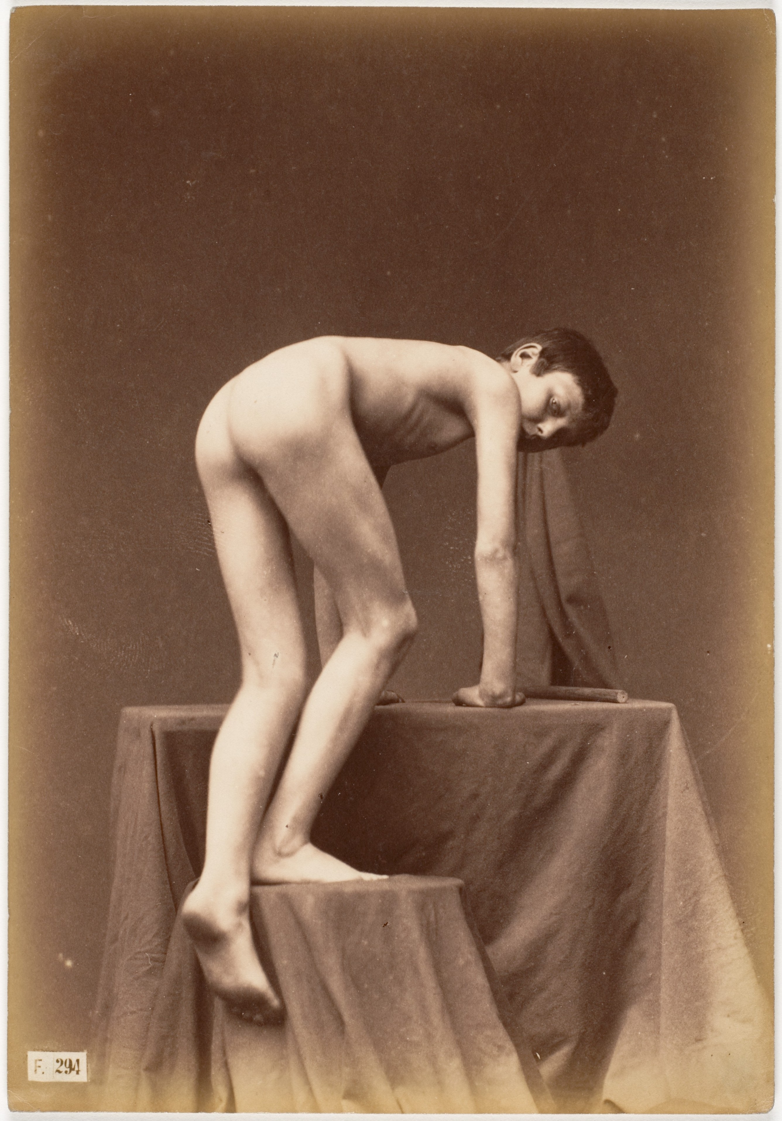 Unknown | [Young Boy, Nude, From the Back, Climbing] | The Metropolitan  Museum of Art