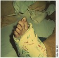[Foot in Cast: Glenn Ives?], Walker Evans  American, Instant internal dye diffusion transfer print (Polaroid SX-70)