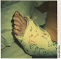 [Foot in Cast: Glenn Ives?], Walker Evans  American, Instant internal dye diffusion transfer print (Polaroid SX-70)