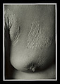 Mother’s 25 March 1916 #53 [breast], Ishiuchi Miyako  Japanese, Gelatin silver print