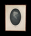 [Profile of a Woman with Necrosis of the Nose], Louis-Auguste Bisson (French, 1814–1876), Daguerreotype