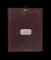 [Profile of a Woman with Necrosis of the Nose], Louis-Auguste Bisson (French, 1814–1876), Daguerreotype
