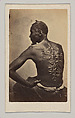Gordon, A Runaway Mississippi Slave,  or "The Scourged Back", McPherson & Oliver  American, Albumen silver print from glass negative