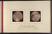 Mikroskopisch-Photographischer Atlas der Harnsedimente, Robert Ultzmann  Austrian, Albumen silver prints
