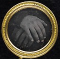 [Button], Unknown, Daguerreotype