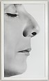 The Plastic Surgery, Sophie Calle (French, born Paris, 1953), Gelatin silver print