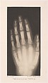 Versuche über Photographie mittelst der Röntgen'schen Strahlen, Josef Maria Eder (Austrian, Krems an der Donau, 1855–1944 Kitzbühel) and, Photogravures