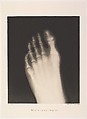 Versuche über Photographie mittelst der Röntgen'schen Strahlen, Josef Maria Eder (Austrian, Krems an der Donau, 1855–1944 Kitzbühel) and, Photogravures