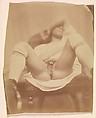 Hermaphrodite, Nadar  French, Albumen silver print from glass negative