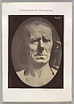 Figure 22: No painful expression
, Guillaume-Benjamin-Amand Duchenne de Boulogne French, Albumen silver print from glass negative