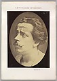 Figure 25: Not an expression of pain, Guillaume-Benjamin-Amand Duchenne de Boulogne French, Albumen silver print from glass negative