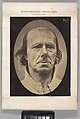 Figure 3: The face of an old man... photographed in repose., Guillaume-Benjamin-Amand Duchenne de Boulogne French, Albumen silver print from glass negative