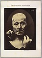 Figure 8: Contraction of the right m. frontalis. 
, Guillaume-Benjamin-Amand Duchenne de Boulogne  French, Albumen silver print from glass negative