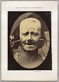 Figure 34: Grimace, Guillaume-Benjamin-Amand Duchenne de Boulogne  French, Albumen silver print from glass negative