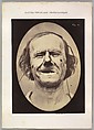 Figure 48: Mild weeping, pity and feeble false laughter
, Guillaume-Benjamin-Amand Duchenne de Boulogne French, Albumen silver print from glass negative