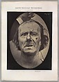 Figure 49: Painful weeping and forward looking., Guillaume-Benjamin-Amand Duchenne de Boulogne French, Albumen silver print from glass negative