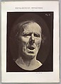 Figure 54: Voluntary lowering of the lower jaw, Guillaume-Benjamin-Amand Duchenne de Boulogne French, Albumen silver print from glass negative