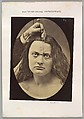 Figure 82: Lady Macbeth, strong expression of cruelty 
, Guillaume-Benjamin-Amand Duchenne de Boulogne  French, Albumen silver print from glass negative