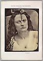 Figure 81: Lady Macbeth, moderate expression of cruelty, Guillaume-Benjamin-Amand Duchenne de Boulogne French, Albumen silver print from glass negative