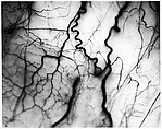[Detail of Veins in Human Eyeball], Harold Edgerton  American, Gelatin silver print