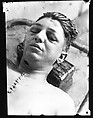 [Copy of Newspaper File Photograph: Corpse with Sutured Chest, Probably Havana], Walker Evans (American, St. Louis, Missouri 1903–1975 New Haven, Connecticut), Film negative