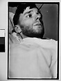 [Self-Portrait in New York Hospital Bed, New York City], Film negative