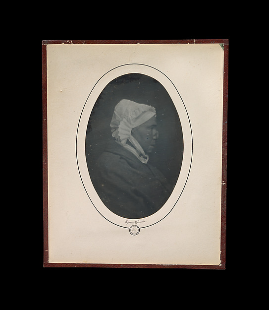[Profile of a Woman with Necrosis of the Nose]