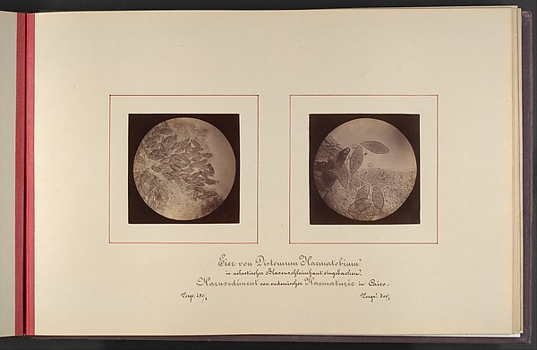 Mikroskopisch-Photographischer Atlas der Harnsedimente — Robert Ultzmann