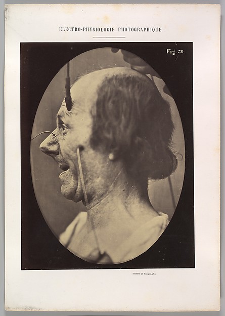 Figure 39: The  attention attracted by an object that provokes lascivious ideas and desires. 