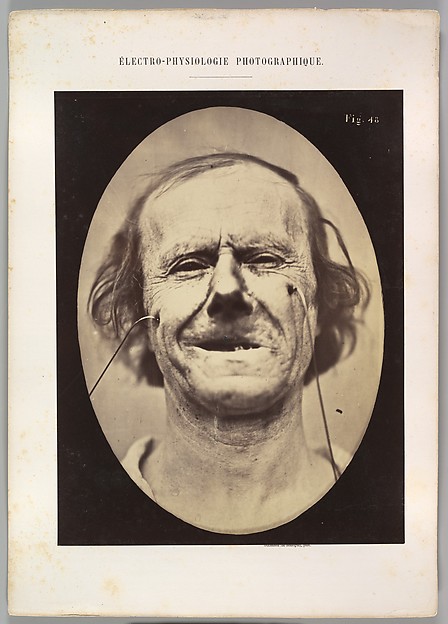 Figure 48: Mild weeping, pity and feeble false laughter