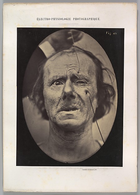 Figure 49: Painful weeping and forward looking.