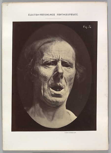 Figure 54: Voluntary lowering of the lower jaw