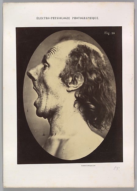 Figure 55: Astonishment badly rendered by the subject: a ridiculous and inane expression. 