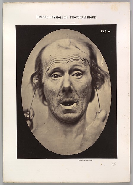 Figure 56: Surprise