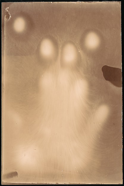 [Effluvia from a Hand Resting on a Photographic Plate]